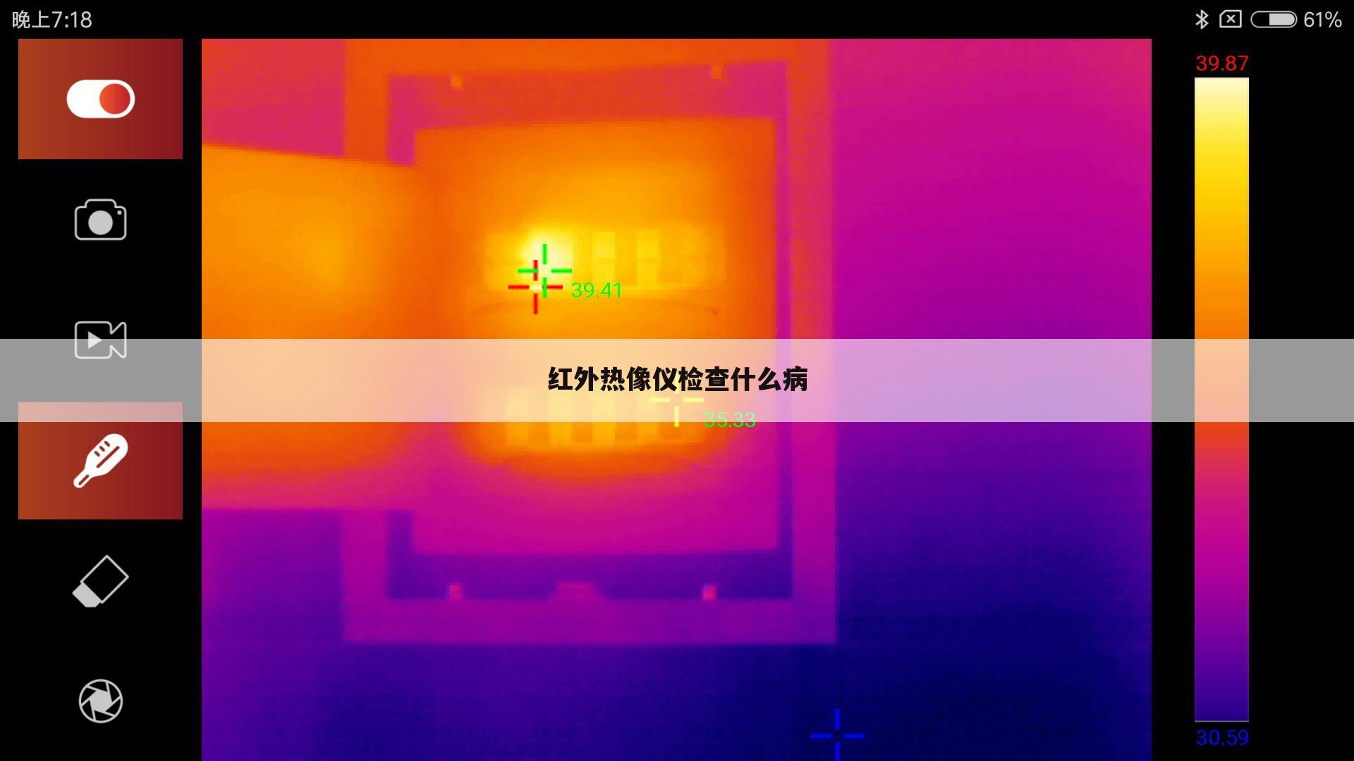 红外热像仪检查什么病