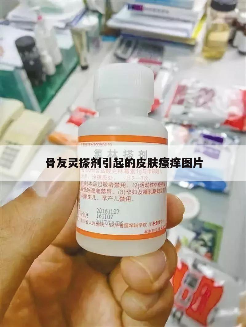 骨友灵搽剂引起的皮肤瘙痒图片