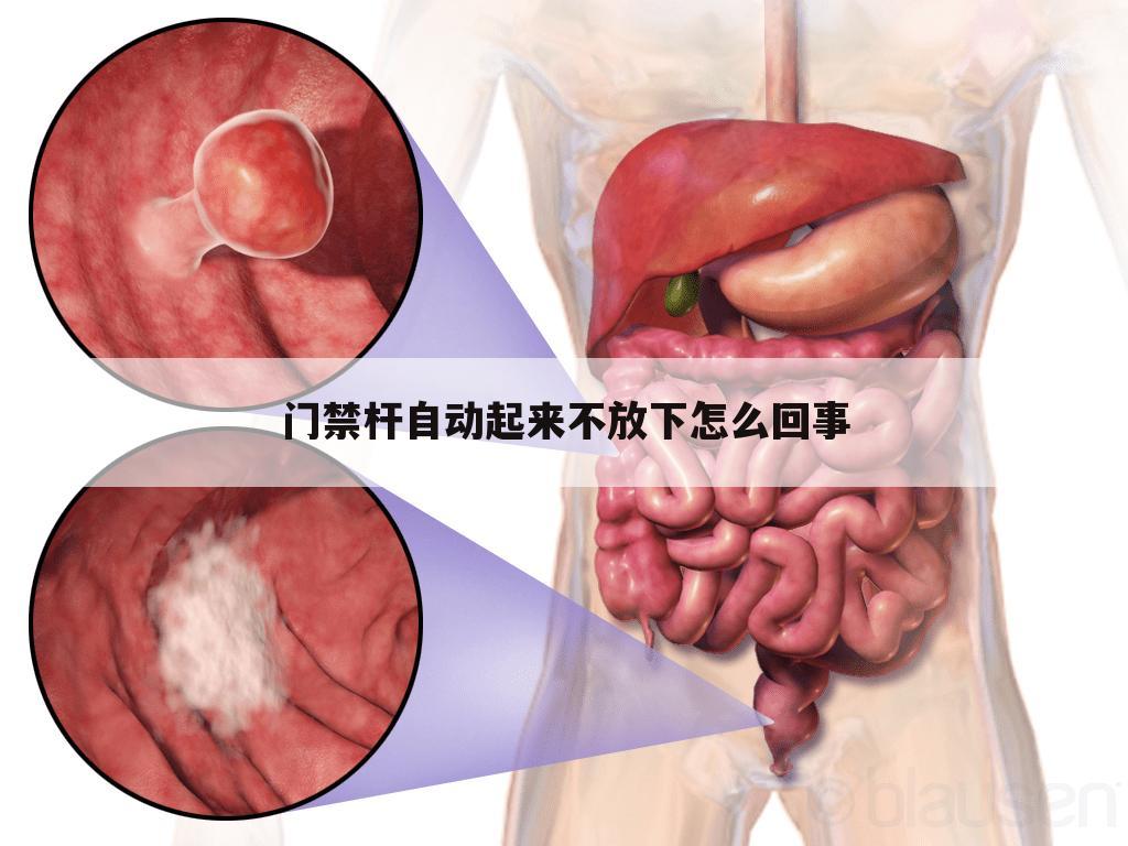 门禁杆自动起来不放下怎么回事